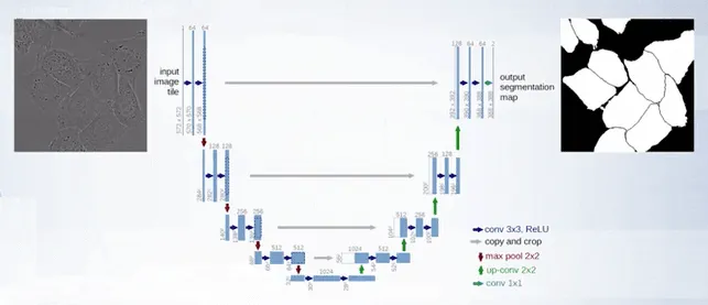 U-Net architecture
